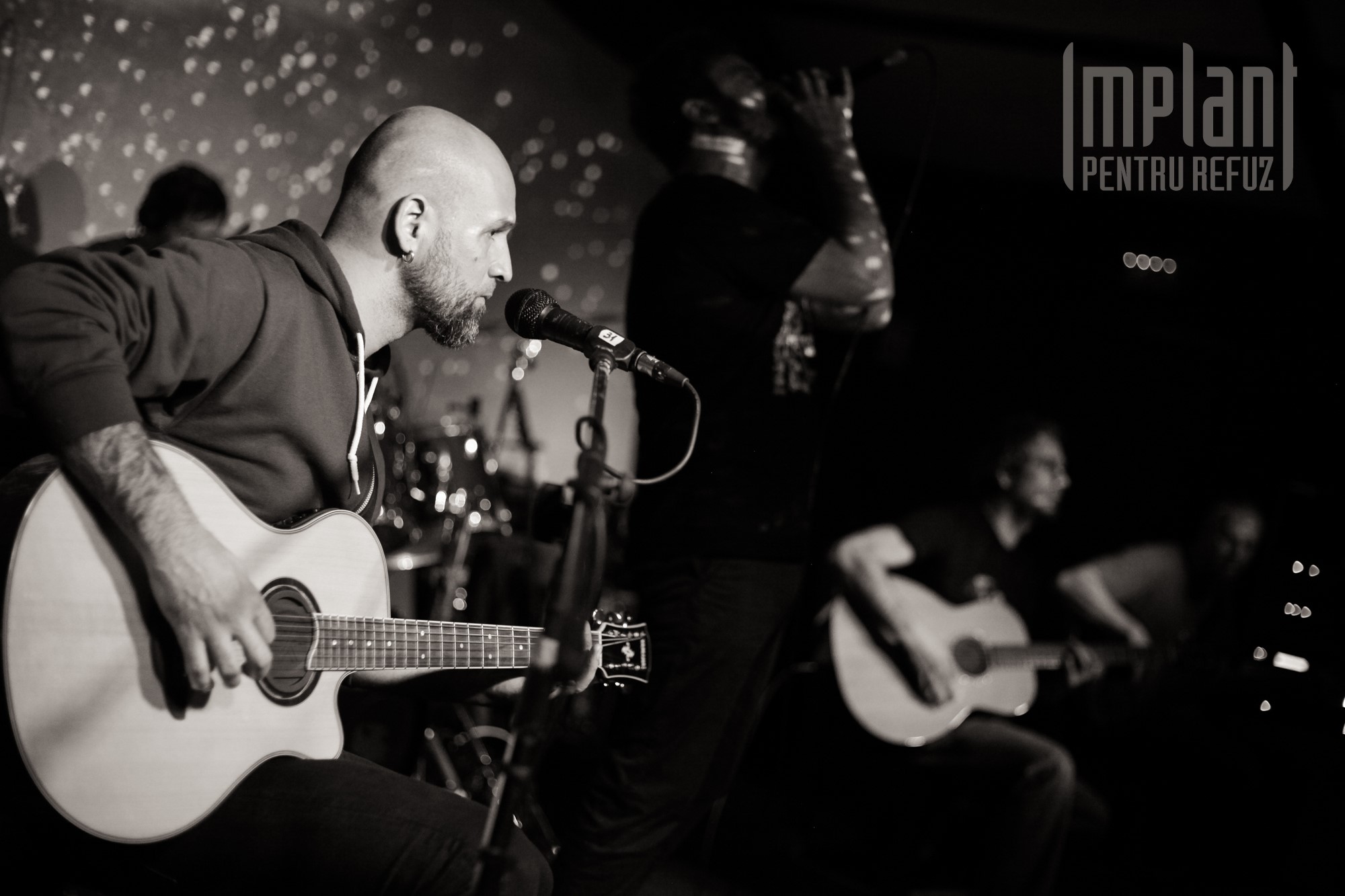 Bilete Implant Pentru Refuz Acustic Expirat 18 04 18 Apr 19 Ora 20 00 Expirat Halele Carol Iabilet Ro